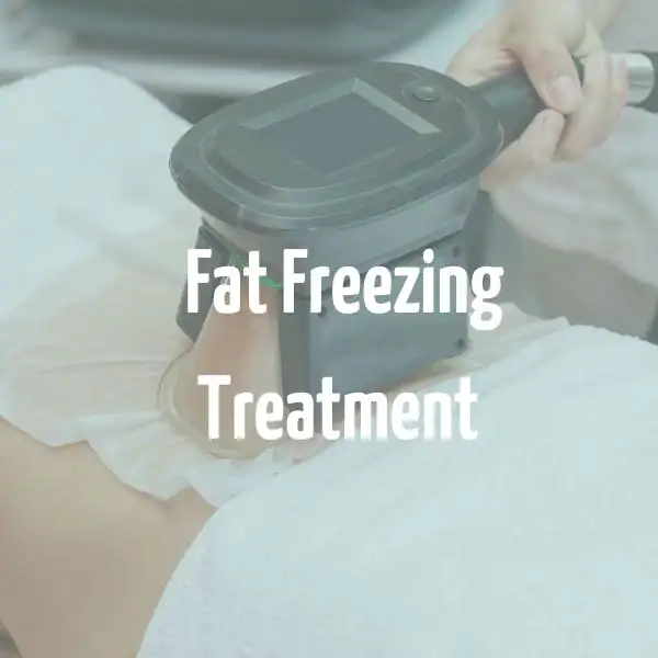 fat freezing treatment Acton