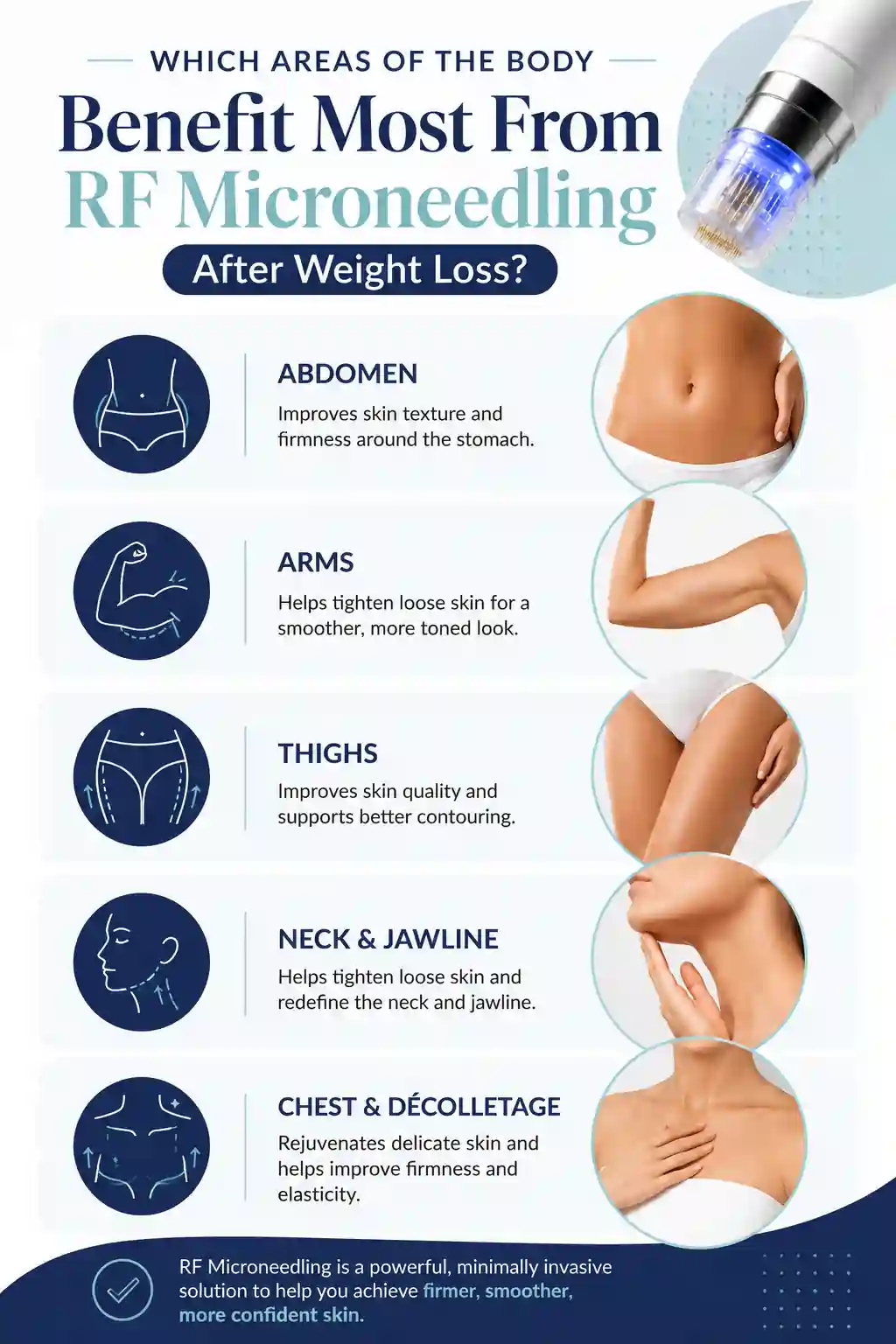 Which Areas of the Body Benefit Most From RF Microneedling After Weight Loss Acton
